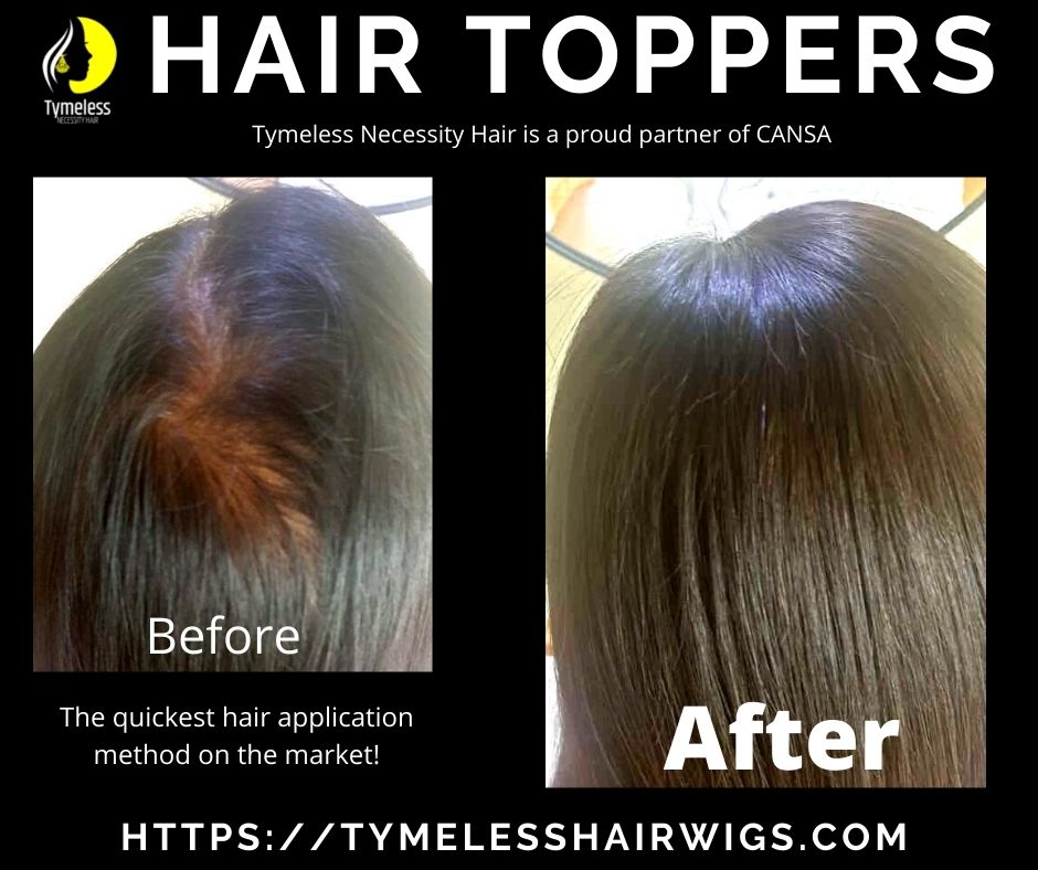 Hair toppers: Cover balding at the click of a finger - Tymeless Hair & Wigs