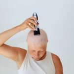 5 Reasons Chemo Can Cause Hair Loss