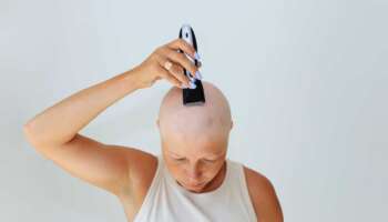 5 Reasons Chemo Can Cause Hair Loss